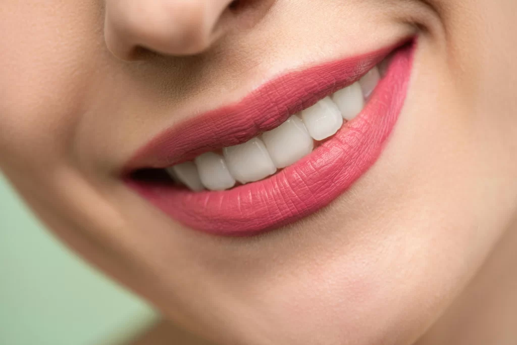 smile makeover consultation