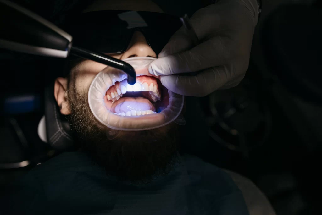 white diet after whitening guidance