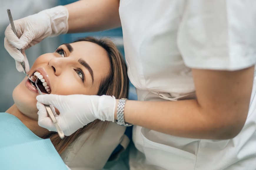 duración carillas dentales – mantenimiento y longevidad